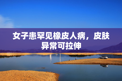 女子患罕见橡皮人病，皮肤异常可拉伸